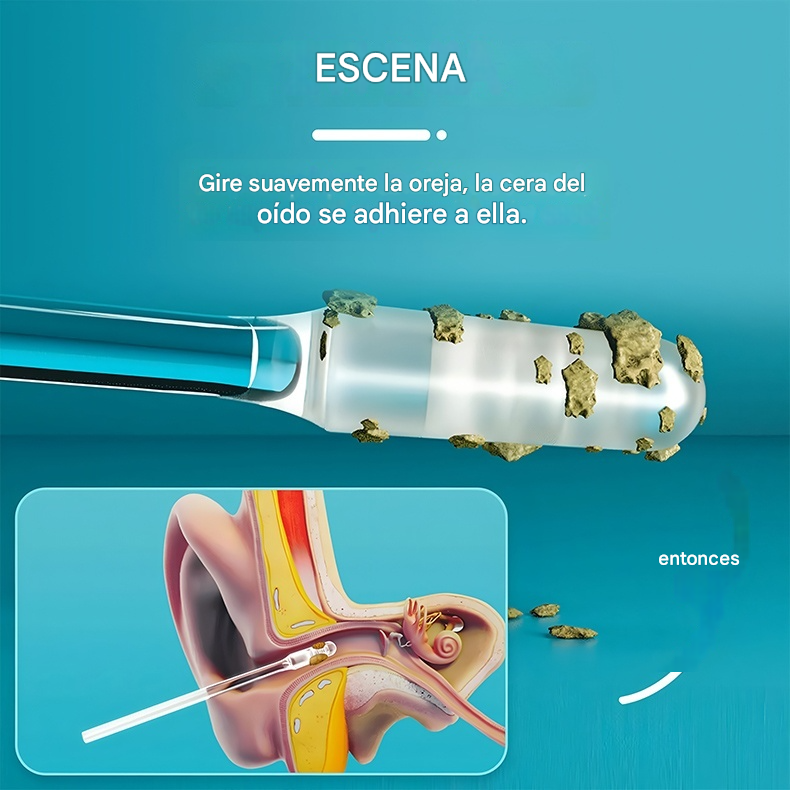 🔥50% de descuento🔥👂[Eliminación de cera extremadamente eficaz] Nuevo palito especial para la limpieza de oídos